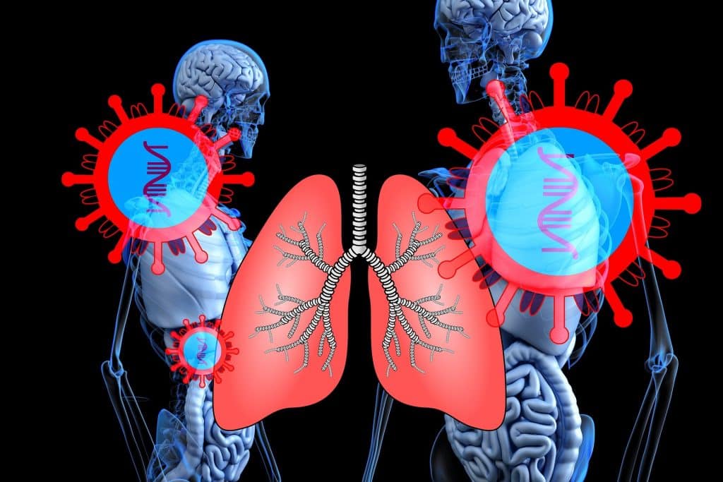 Korona virus simptomi znaci bolest pluća